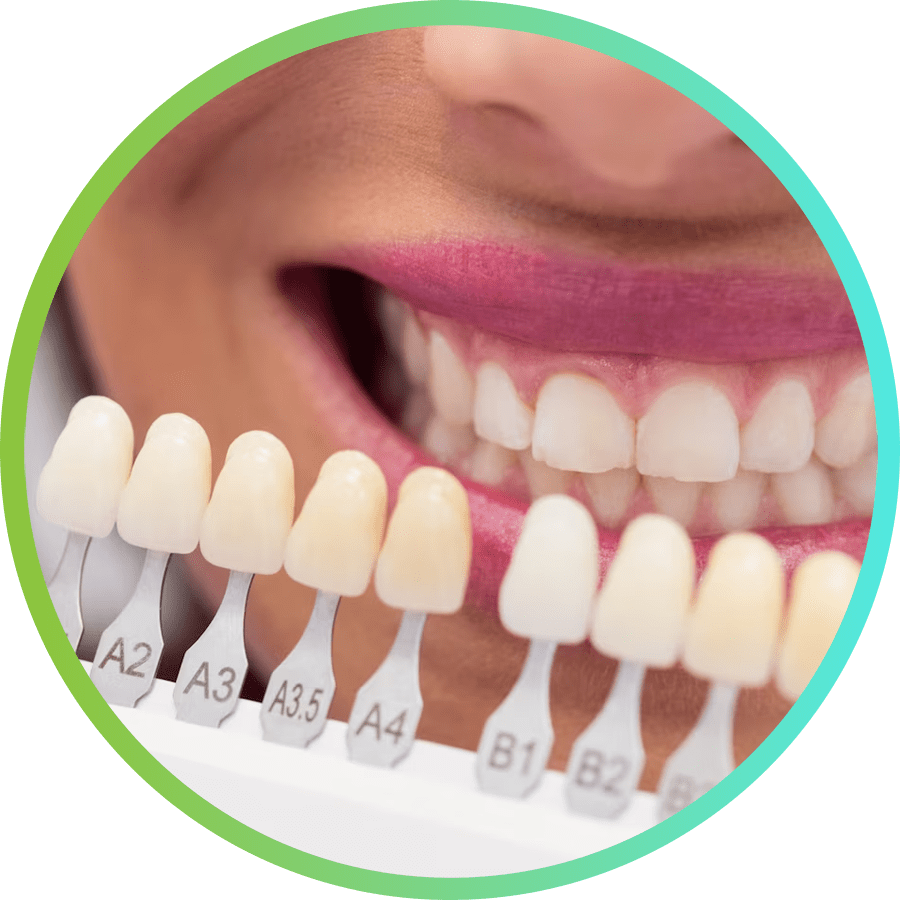 Odontología cosmética - Dental Familia