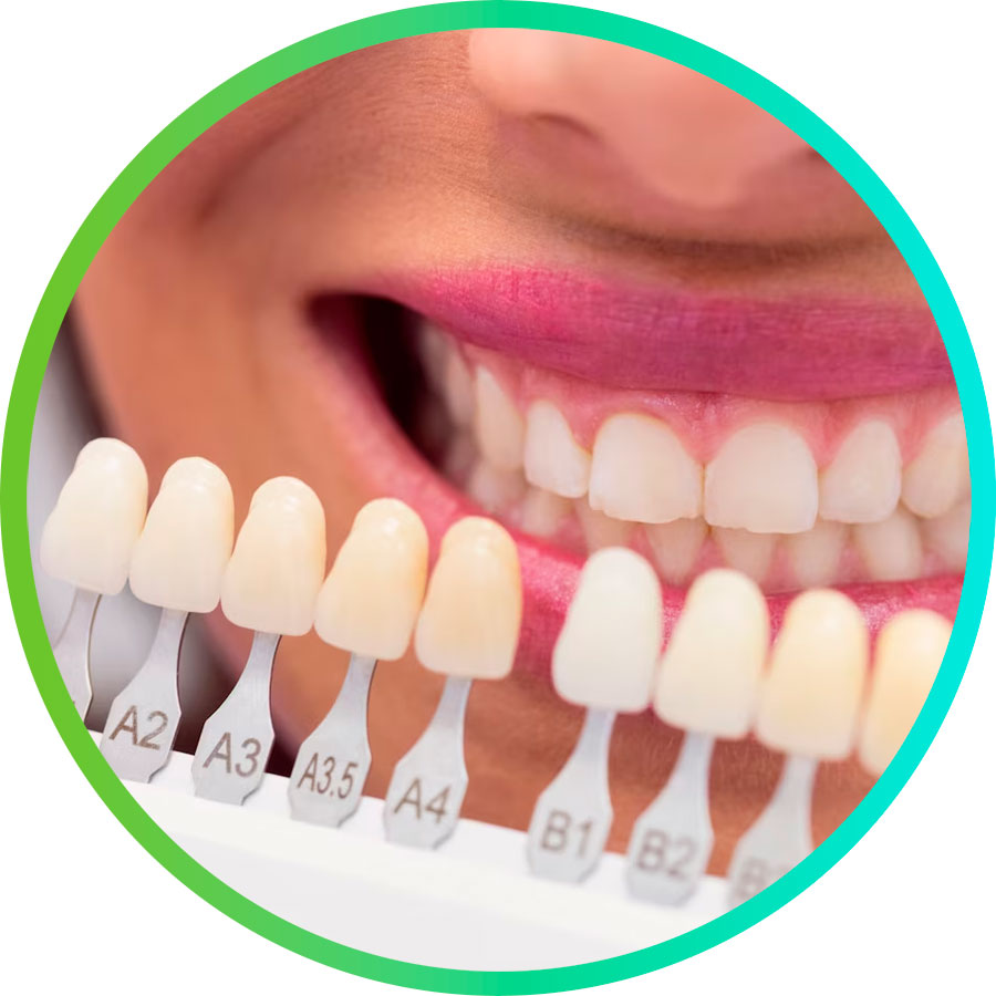 Odontología cosmética - Dental Familia